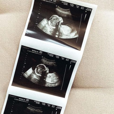 blood type and pregnancy