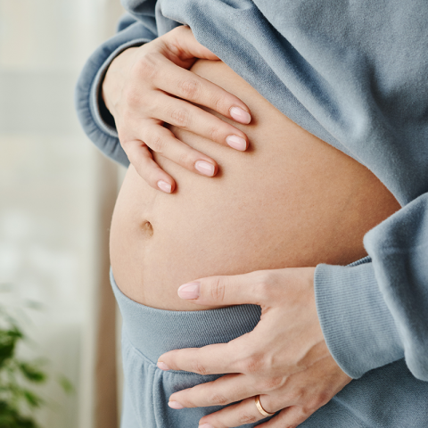 pregnancy stretch marks