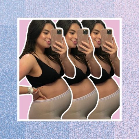 postpartum hemorrhoids