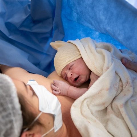 anesthesia failed during c-section